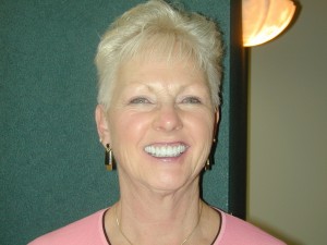 Smile Makeover After Smile Makeover After