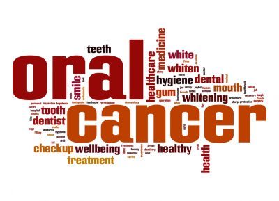 Oral Cancer Screening - Shelby Twp., MI