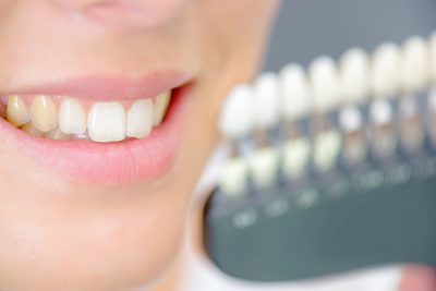 Causes of Stained Teeth - White Teeth Shelby Twp Dentist