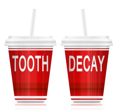 Childrens Tooth Decay - Kids Dentist in Shelby Twp., MI