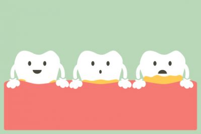 What Every Patient Needs to Know About Gum Disease