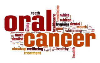 Oral Cancer Screening - Shelby Twp., MI