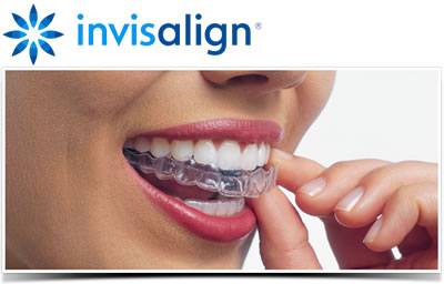 Invisalign Dentist Shelby Twp MI