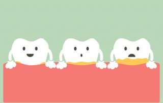 What Every Patient Needs to Know About Gum Disease