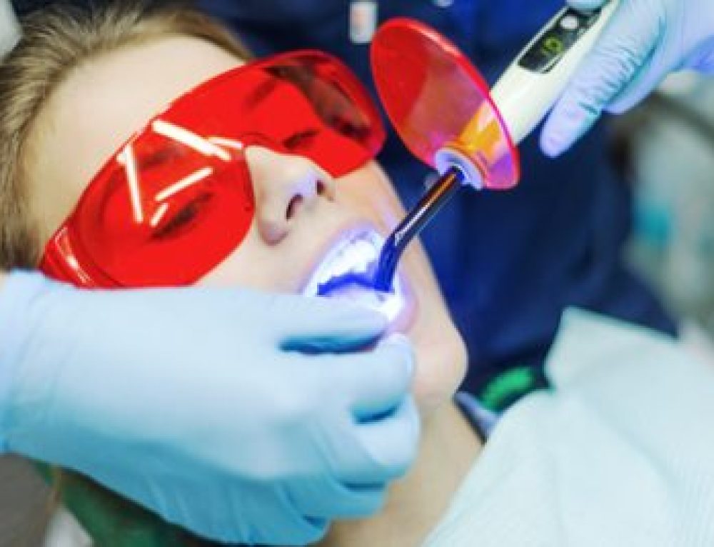 What to Know About Soft Tissue Laser Therapy