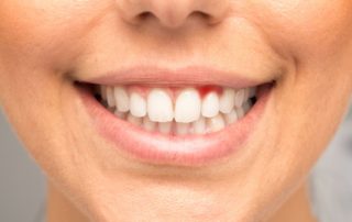 The Importance of Having Healthy Gums