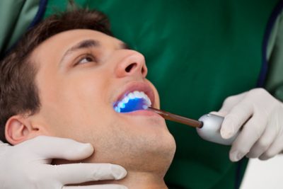 Tackling Tough Dental Sealant Questions