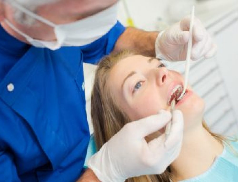 Dental Bonding What You Need to Know