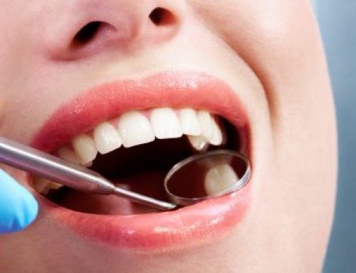 A Guide to Dental Fillings: All you need to know about Composite Fillings