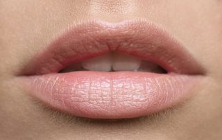 All You Need to Know About Lip Cancer