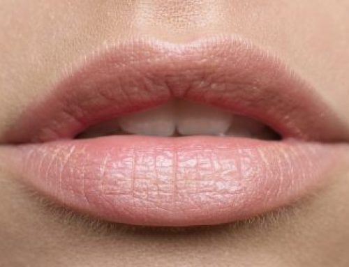 All You Need to Know About Lip Cancer
