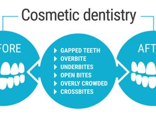How Will Cosmetic Dentistry Impact Your Life?