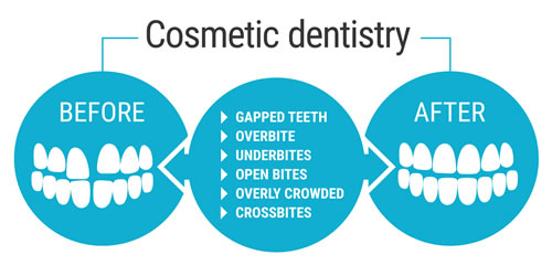 Cosmetic Dentistry - Before and After