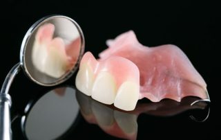 Partial Denture - Shelby Twp Dentist