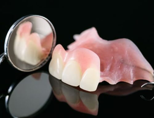 What Are The Benefits of Partial Dentures?