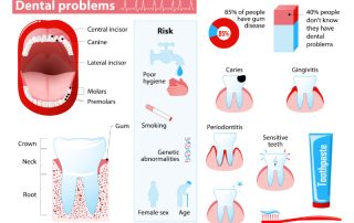 Common Dental Problems - Shelby Township Dental Office