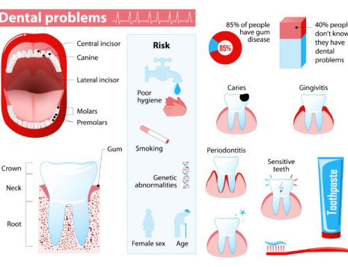 Common Dental Problems and How to Avoid Them