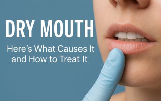 Dry Mouth Cause and Treatments